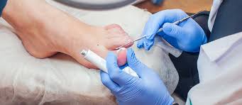 Online skin and wound management course. Foot Care Nurse Certification Program Ontario