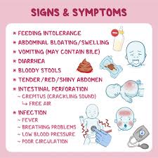 Image result for Necrotizing Enterocolitis