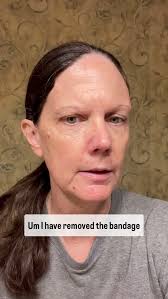 The bandage is off. If you don’t want to see the incision, scroll