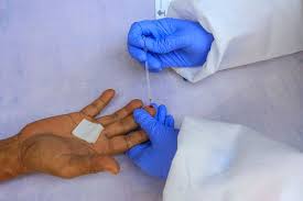 Saat ini tim seleksi sudah memasuki tahap. Dipatok Tertinggi Rp 150 000 Berapa Sebenarnya Harga Alat Rapid Test Halaman All Kompas Com