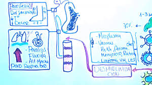 About 75% of patients have a history of preceding infection. Guillain Barre Etiopatogenia Fisiopatologia Diagnostico Tratamiento Youtube