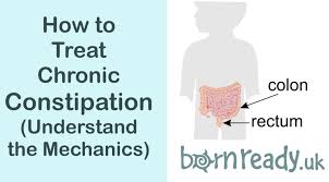 the mechanics of chronic constipation and how to treat it