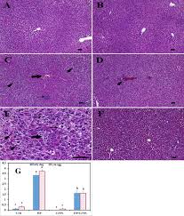 Guarantees do not assure good test results! The Potential Ameliorative Impacts Of Cerium Oxide Nanoparticles Against Fipronil Induced Hepatic Steatosis Scientific Reports