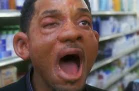$12 fire & ice wedge. Don T Be Like Alex Hitchens Will Smith And Find Out Late That You Have A Food Allergy Contact Dr Andrew Lozano Today To Allergies Quote Hitched Hitch Movie