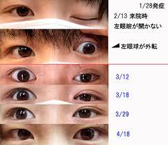 量子 波 治療