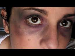 Oeil Au Beurre Noir Tuto By Pauline A Youtube