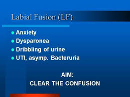 Image result for Labial Fusion