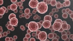 Cancers on the list are linked to information about treatment, supportive care, screening, prevention, clinical trials, and other topics. Study 6 3 Of Breast Ovarian Cancers In Cayman Found To Be Hereditary Loop Cayman Islands