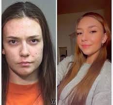 ❤️‍🩹”Hi! My name is Emily and these are my before and after photos. I'm  now 13 months clean from f3ntanyl and I'm finally lovin life again” 🤍  -Let's all show some love