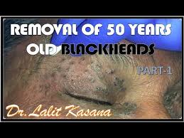 Use custom templates to tell the right story for your business. Best Blackhead Popping And Removal Videos Of 2018 Insider