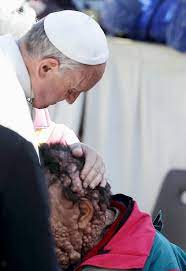 Pope Francis hugs man disfigured by tumours - Mirror Online