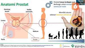 Pemeriksaan prostat adalah pertahanan terbaik anda terhadap kanker prostat. Gangguan Kencing Bisa Jadi Gejala Kanker Prostat Begini Cara Pemeriksaannya Health Liputan6 Com