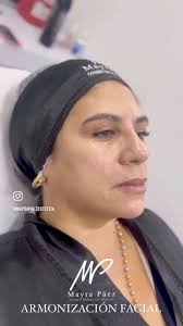 Rejuvenecimiento inteligente ARMONIZACIÓN FACIAL😍 no es moda, es la  necesidad de acuerdo a tu edad, tipo de piel y textura sin excesos atrévete  a rejuvenecer sin miedo agenda tu cita 3156001478 ...