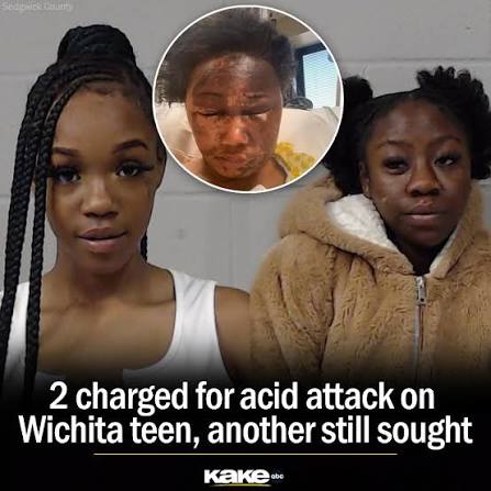 3 Teens Charged in Connection to Drive-by Acid Attack That Left 6 Women  Injured 📷: Getty Stock Images/iStockphoto