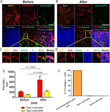 Pus in a perinephric abscess or blood from a ruptured kidney (perirenal effusions) will first distend. Type 1 Pericytes Accumulate After Tissue Injury And Produce Collagen In An Organ Dependent Manner Stem Cell Research Therapy Full Text