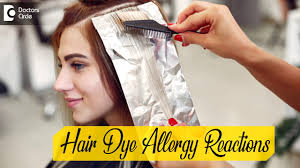 In moderate cases it can cause reddening of skin in your scalp. Allergic Reaction To Hair Dye And Face Swelling Dr Rashmi Ravindra Doctors Circle Youtube
