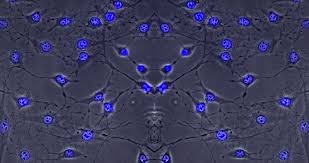 Stem Cells For Degenerative Disc Disease Anova Irm Germany