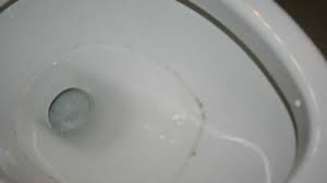 Check spelling or type a new query. Toilet Bowl Ring 3 Different Types Ask A House Cleaner