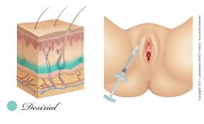 Chirurgie Genitale Feminine Marseille