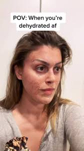 Dehydration POV: Madison Russo