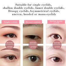 How do i know i have an uneven smile? Uneven Double Eyelid Cheaper Than Retail Price Buy Clothing Accessories And Lifestyle Products For Women Men
