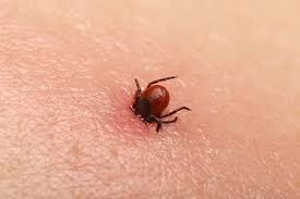 If you are removing a tick do not squeeze the end (the bloodsack.) this can cause the blood that the tick has gotton from other animals into your bloodstream and may give you a disease. Protect Yourself Against Tick Bites Nidirect