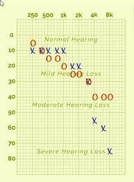 It will tell you how old your ears are and reveal your hearing range. How Accurate Are Online Hearing Test Question And Answer Hearing Aid Forum Active Hearing Loss Community