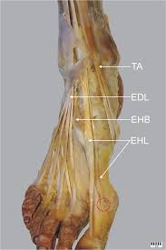 The extensor digitorum longus is a pennate muscle, situated at the lateral part of the front of the leg. A Cadaveric Study Of The Morphology Of The Extensor Hallucis Longus A Proposal For A New Classification Bmc Musculoskeletal Disorders Full Text