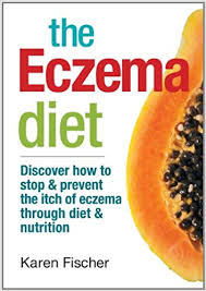 The Eczema Diet Discover How To Stop And Prevent The Itch