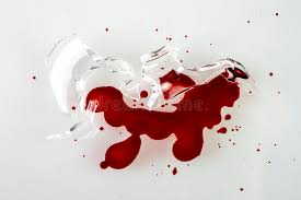 Find over 100+ of the best free blood images. 7 369 Accident Blood Photos Free Royalty Free Stock Photos From Dreamstime