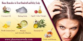 Looking for dandruff removal home remedies? Best Home Remedies For Dandruff