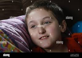 Sindrome di dravet immagini e fotografie stock ad alta risoluzione