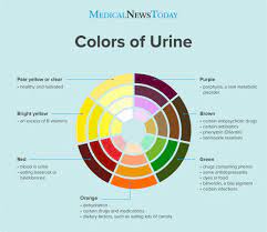 Examples include diabetes mellitus, various forms of glomerulonephritis, and chronic urinary tract infections. Bright Yellow Urine Colors Changes And Causes