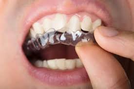4 offers from $18.99 #14. Braces Faqs Frequently Asked Questions About Braces Orthodontics
