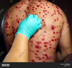 A small signboard outside the office of a lawyer or doctor, e.g. Skin Rash Treatment On Image Photo Free Trial Bigstock