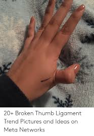 We talk about how a broken thumb occurs, the difference between this type of finger injury compared to others. 20 Broken Thumb Ligament Trend Pictures And Ideas On Meta Networks Pictures Meme On Me Me