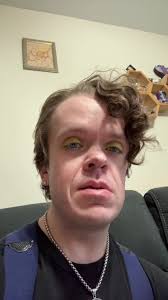 What Happened to Kobi Griffin