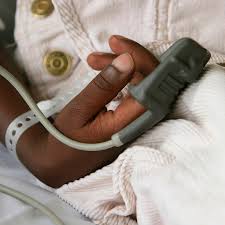 Wellue kidso2 children oxygen monitor updated on 12/14/2020 by rick stella: Pulse Oximeters And Coronavirus Devices Have Higher Error Rate In Black Patients The New York Times