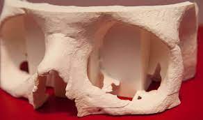 3d Printing Helps Surgeons To Operate Faster Printing Help 3d Printing 3d Printing Technology