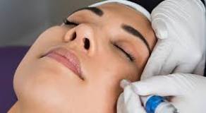 Image result for what to do after microneedling treatment