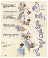 Benign positional vertigo is also called benign paroxysmal positional vertigo (bppv). Epley Maneuver For Bppv Canalith Repositioning Management Grepmed