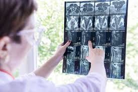 Debe realizar la dieta que se adjunta. Rmn Mana Picior Glezna Genunchi Cot Preturi Avantajoase Departament De Imagistica Deschis La Centrokinetic