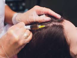 One can stimulate the growth of damaged hair follicles due to the trichotillomania or traction alopecia. Plasma Injections For Hair Loss What You Need To Know Femina In