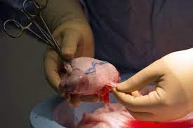 Maybe you would like to learn more about one of these? How Much Is Life Worth The Medical Futurist