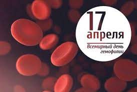 Самый полный календарь праздников на 17 апреля. Kakie Prazdniki Otmechayut V Ukraine I Mire 17 Aprelya Zi Novostnoj Portal
