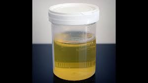 Penyanyi kumpulan floor 88, ayie sanggup menjalani ujian air kencing bagi membuktikan dirinya bebas dadah seperti didakwa banyak pihak. Parti Dadah Sampel Air Kencing 16 Individu Ditahan Disaring Kali Kedua Kata Polis Buletin Ttkm