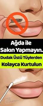 Cimbiz Ve Agda Ile Sakin Almayin Biyik Bolgesinde Tuylenme Kadinlar Icin Can Sikici Estetiksel Sorunlardandir Dudak Ustu Tuyl Health Beauty Mask Lip Wrinkles
