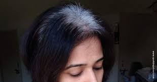 Just consider within the haste of covering grey hair ,do not discover cheap hair dyes and hair products, these will damage the head of hair. Awesome Products To Hide Grey Hair