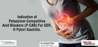 Image result for Potassium Competitive Acid Blocker