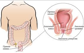 что нужно выпить чтобы сходить в туалет по большому Ob Analnyh Treshinah Memorial Sloan Kettering Cancer Center